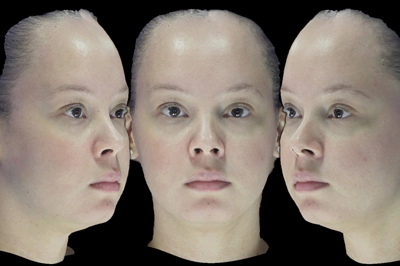 Análise Facial 3D